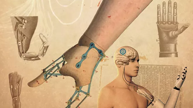 Image: We Can Build a Better Artificial Limb