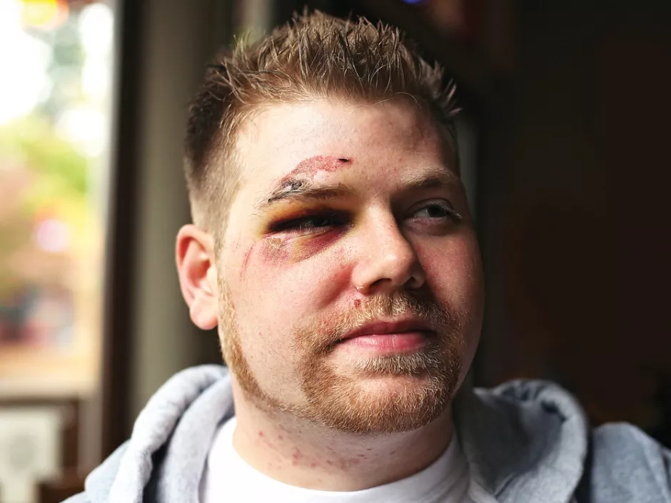 Apology, but no charges, in gay assault case