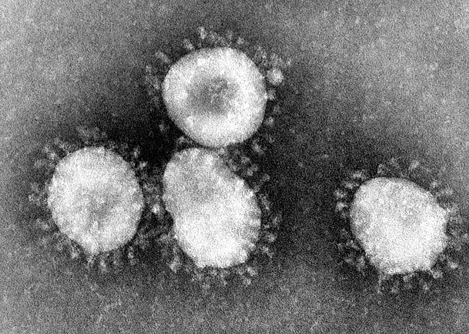 First US case of coronavirus hits Snohomish County, day two of impeachment trial begins, and other headlines