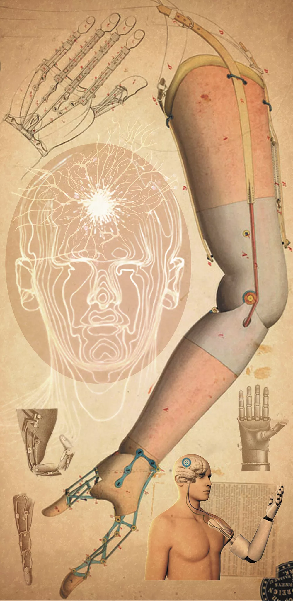 We Can Build a Better Artificial Limb